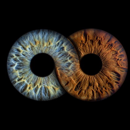 Couple Iris – Infinity